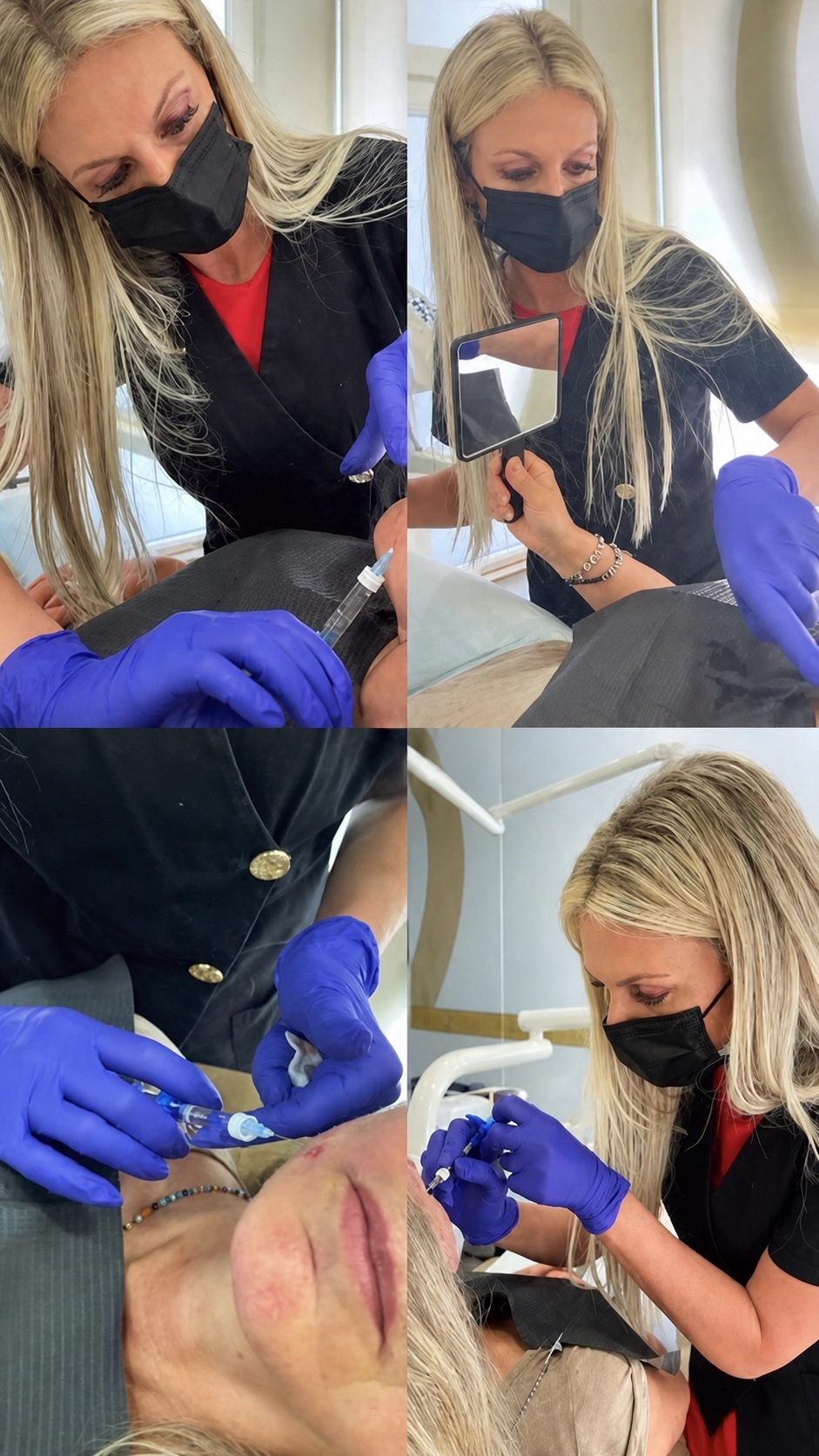 Tratamento de harmonização orofacial na Clínica Cátia Madeira